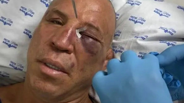 UFC老将万德雷·席尔瓦赛后发生冲突被打晕昏迷